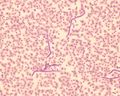 Leguan-mikrofilarien klein.jpg